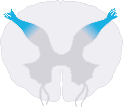 Inibizione neurale diretta Inibizione neurale diretta